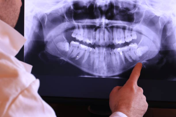 Best Knocked-Out Tooth Emergency  in Mitchellville, IA